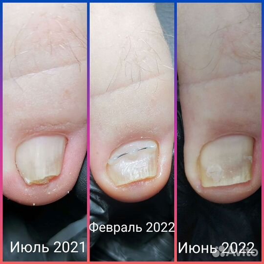 Подолог. Маникюр. Педикюр. Студия Нины Федоровой