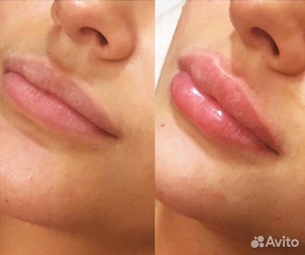 Косметолог эстетист резюме