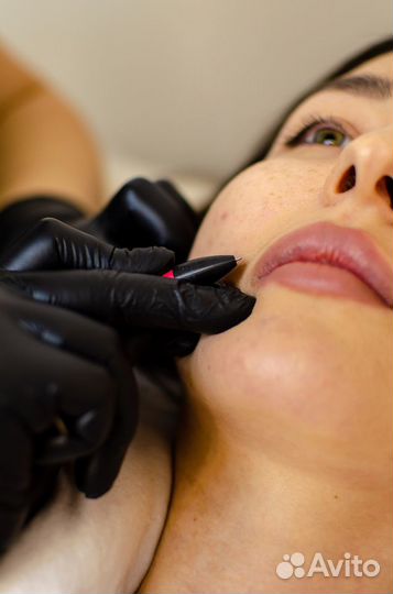 Микротерм Обучение Эпилятор Микро-терм Рассрочка