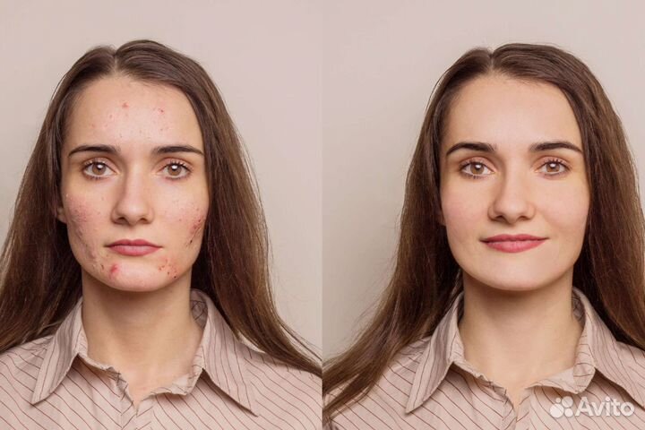 Чистка. Замена термопасты. Обработка фото