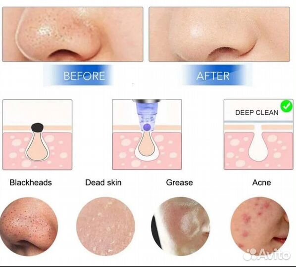 Вакуумный очиститель для лица