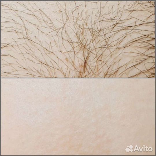 Шугаринг обучение