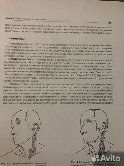 Книга триггереые точки