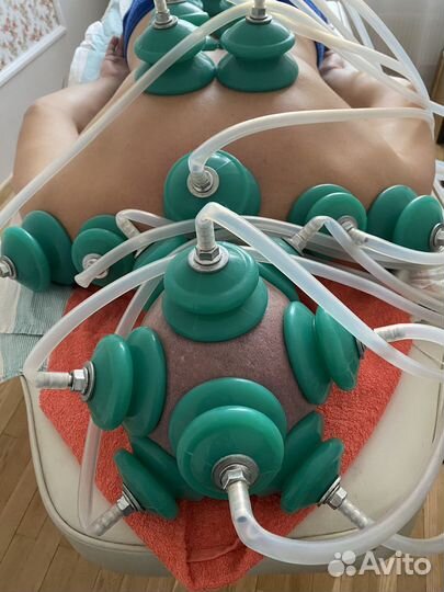 Массаж вакуумный, висцеральный, обучение хиджаме