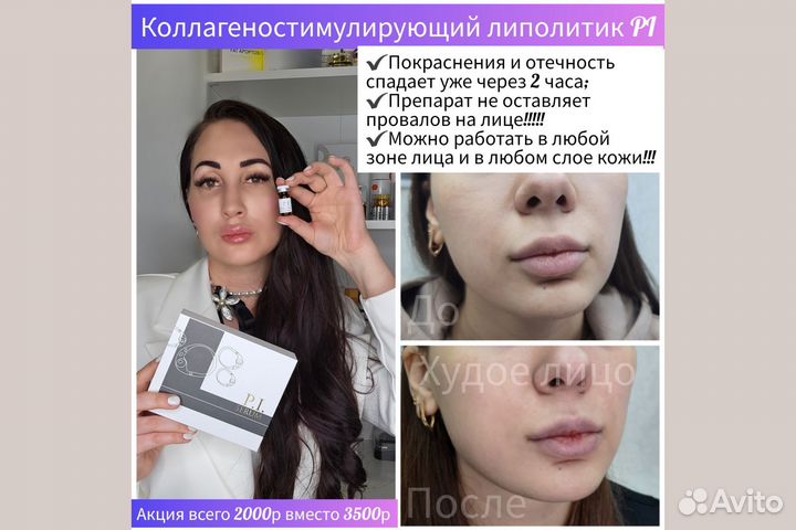 Косметолог уберу брыли