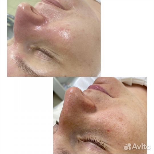 Услуги косметолога