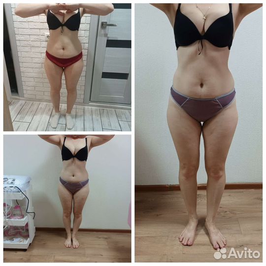 Ищу моделей на ручной антицеллюлитный масаж