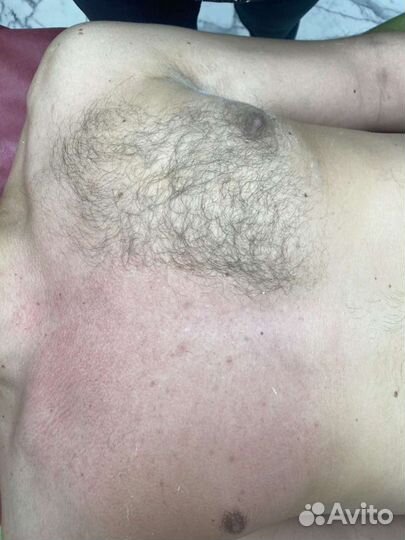 Депиляция (мужчины/женщины ул. Аэродромная, 111А)