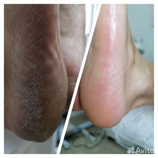 Педикюр, маникюр, шугаринг