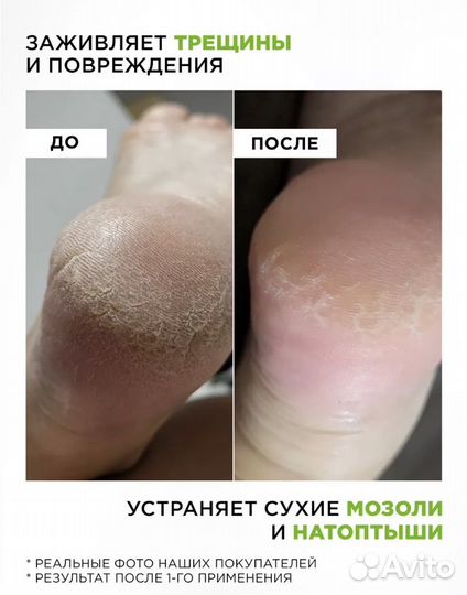 Mixit увлажняющий кератолик для ног