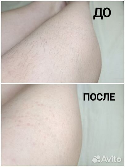 Депиляция воском