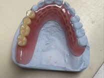 Изготовление и ремонт зубных протезов