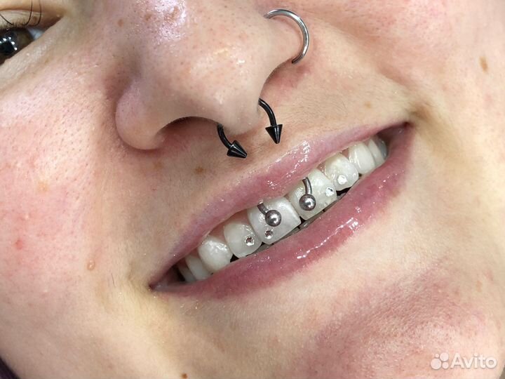 Материалы для установки скайсов