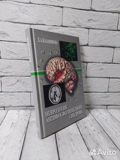 Неврология антифосфолипидного синдрома