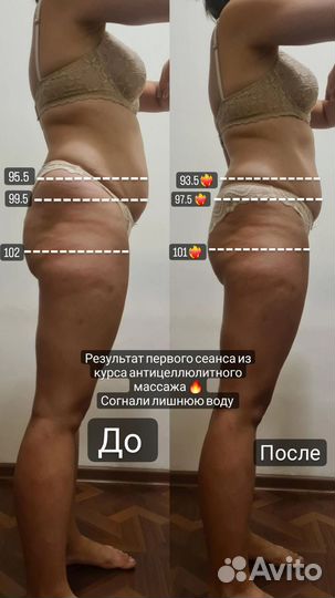 Профессиональный массаж, выезд на дом (юг)