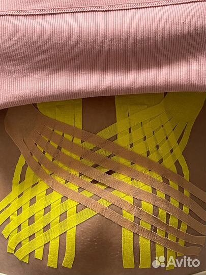 Тейпирование