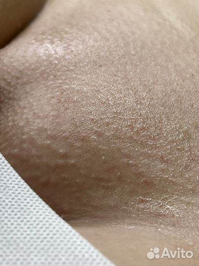 Шугаринг депиляция