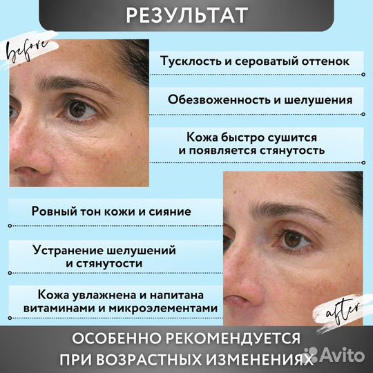 Набор масок для гладкой и упругой кожи