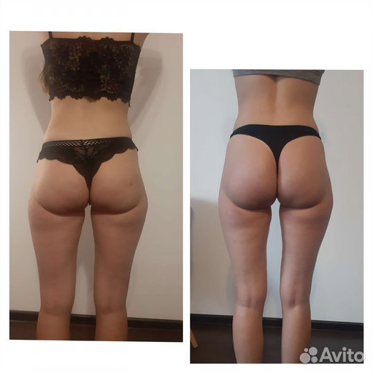 Массаж тела,массаж лица,кавитация,rf лифтинг