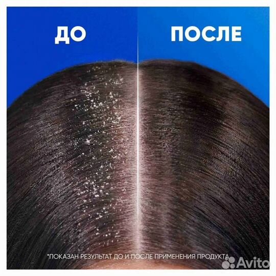 Шампунь head shoulders