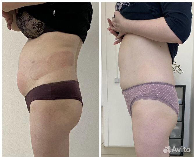 LPG вортекс бифлекси