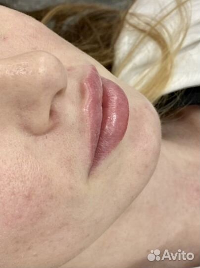 Обучение, практика для косметологов