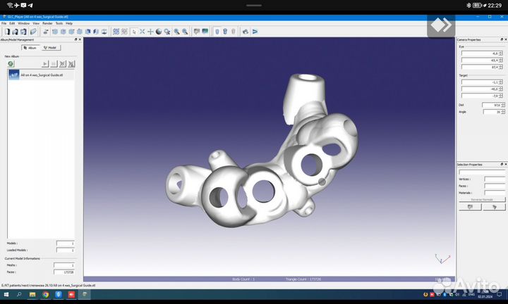 Хирургический шаблон RealGuide,BlueSkyPlan,ExoCad