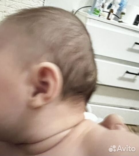 Ортопедический шлем