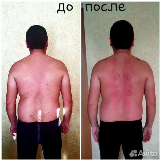 Профессиональный массаж