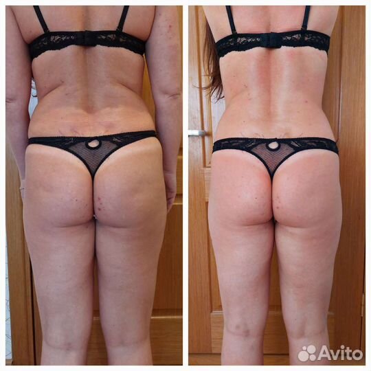 Абонемент на курс коррекции фигуры