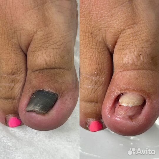 Услуги подолога