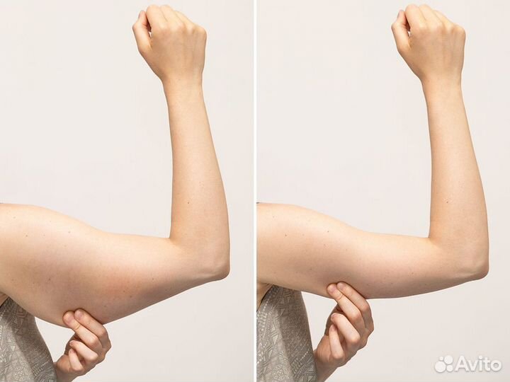 Модели на Кавитация Рук