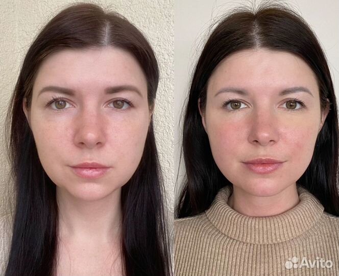 Массаж лица