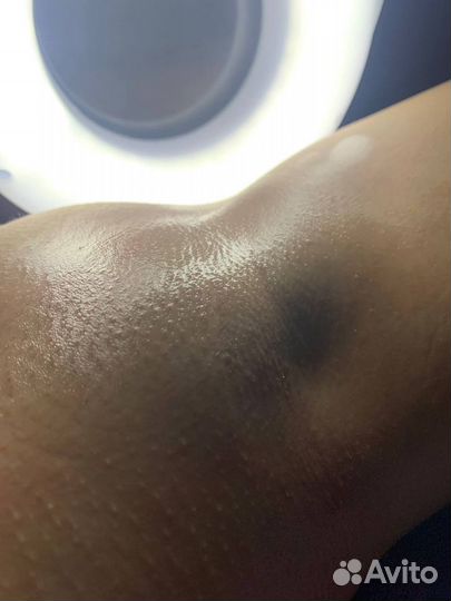 Депиляция мужская женская шугаринг косметология