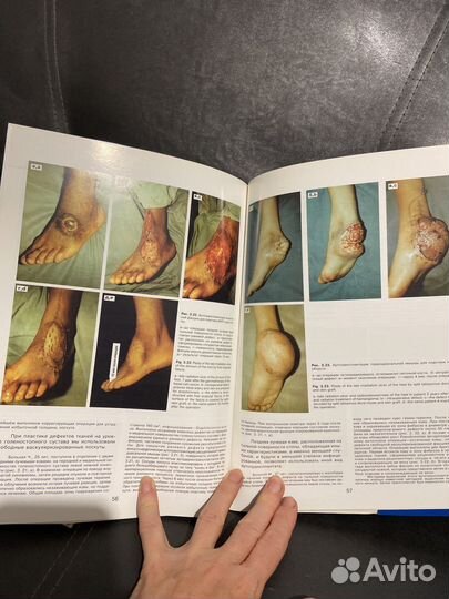 Книги по хирургии Миланов Шилов