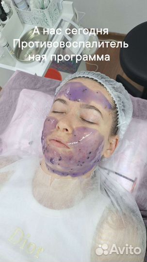 Шугаринг, эстетика лица