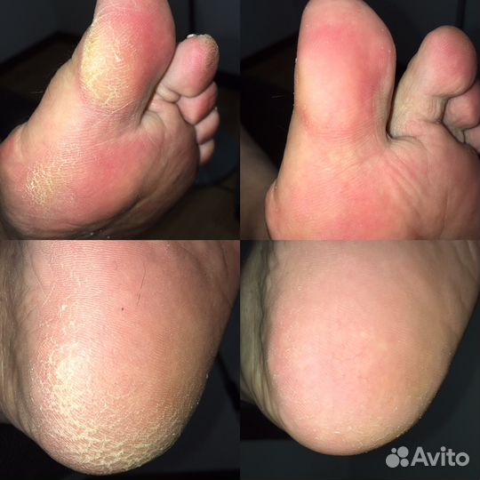 Маникюр, Педикюр