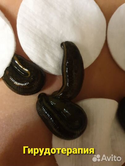 Массаж Микротоки Купон на гирудотерапию