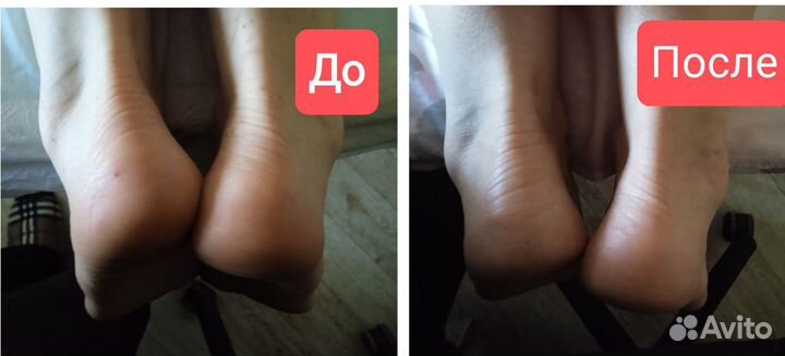 Оздоровительные практики (оздоровительный массаж)