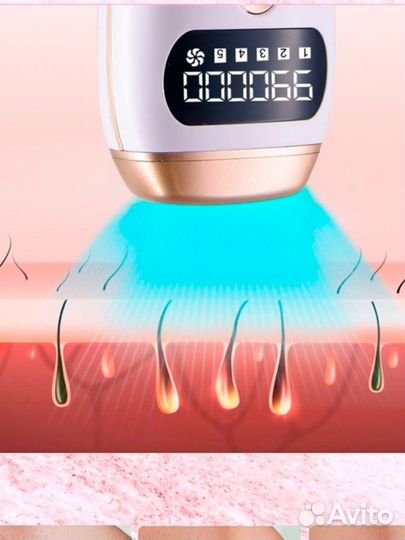 Фотоэпилятор