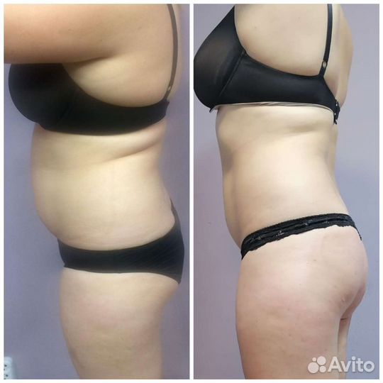 Коррекция фигуры