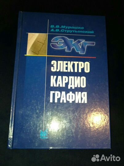 Электрокардиография