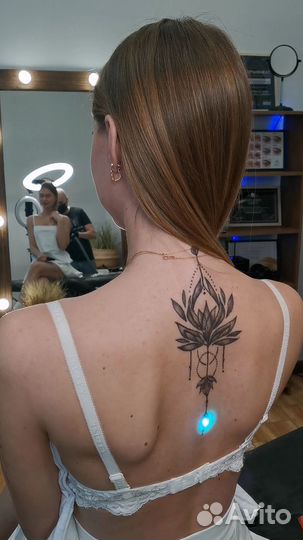 Удаление татуировок