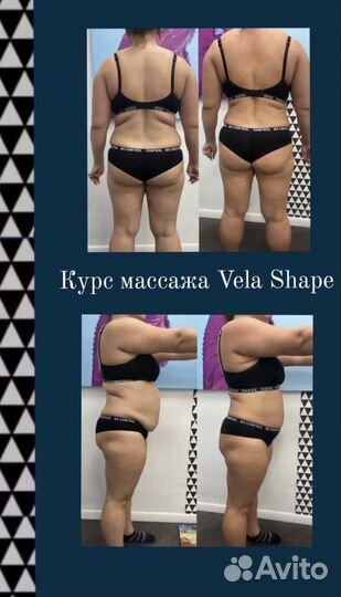 Массаж Vela Shape (LPG) 4 зоны 40 минут
