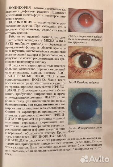 Оптометрия для начинающих оптометристов