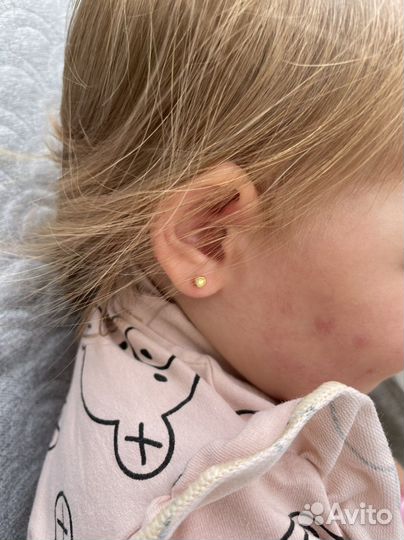 Прокол ушей, пупка,носа. Обучение. Врач косметолог