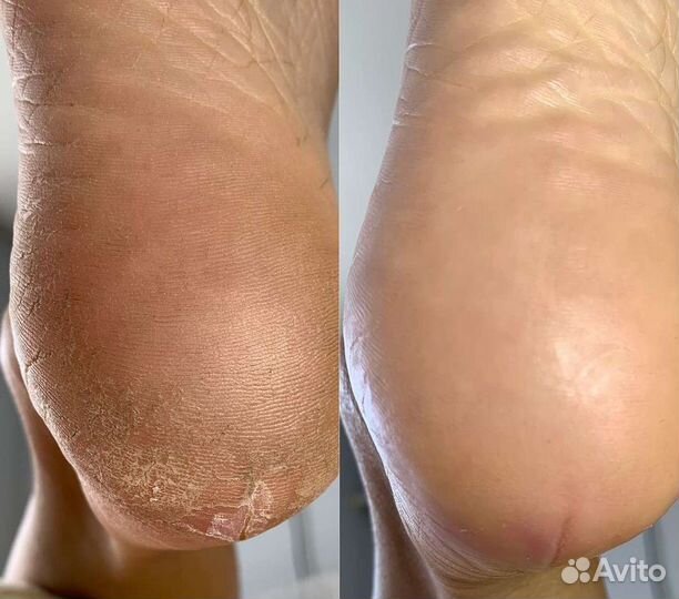 Педикюр,Маникюр