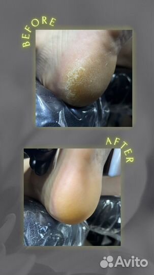 Обучение, педикюр