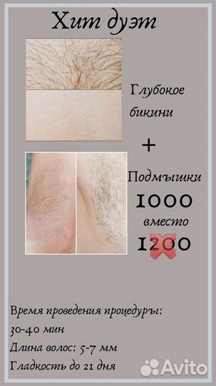 Шугаринг обучение