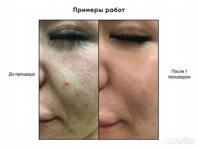 Модели на холодную плазму в Екатеринбурге | Услуги | Авито